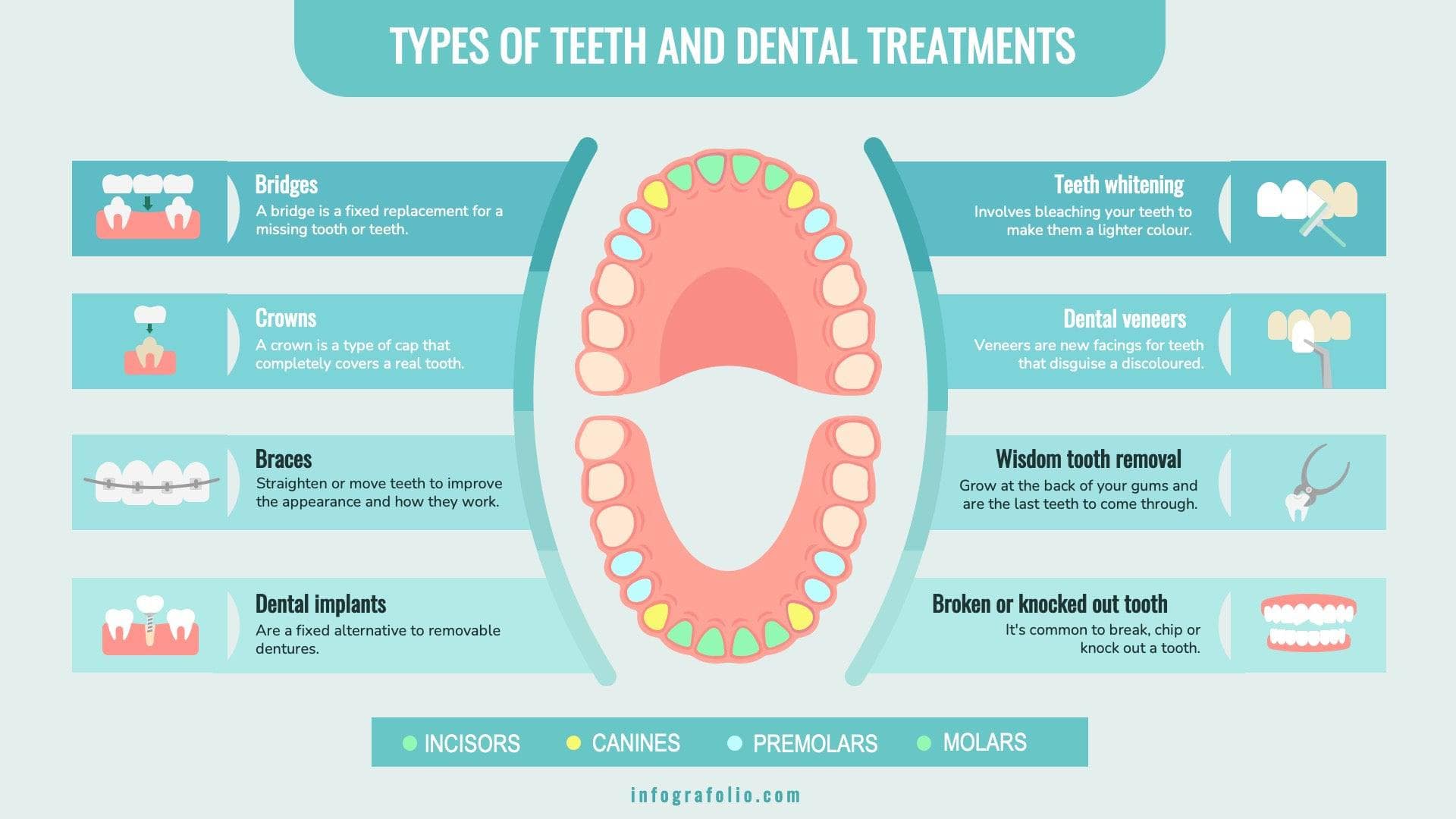 Types of Teeth and Dental Treatments Anatomy Infographic Template ...