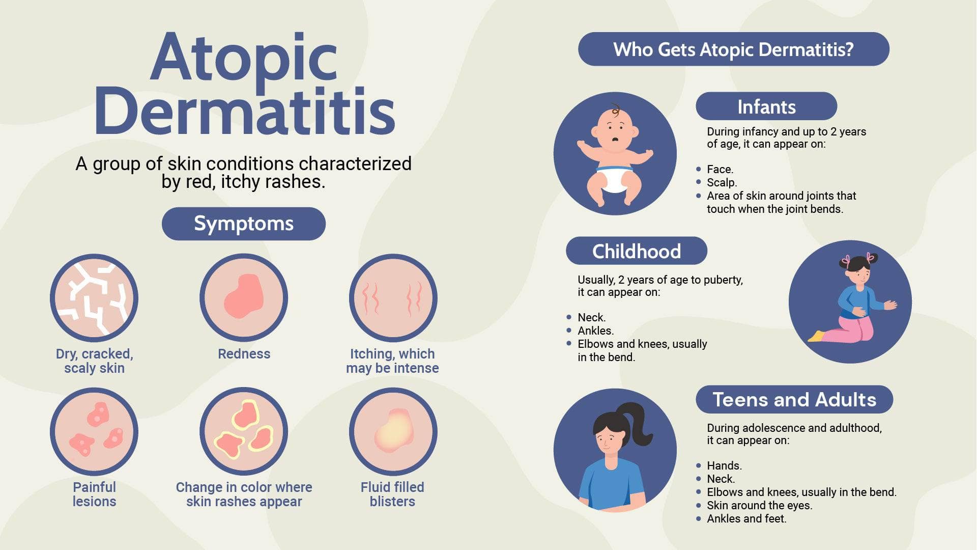 Atopic Dermatitis Health Infographic Template – Infografolio