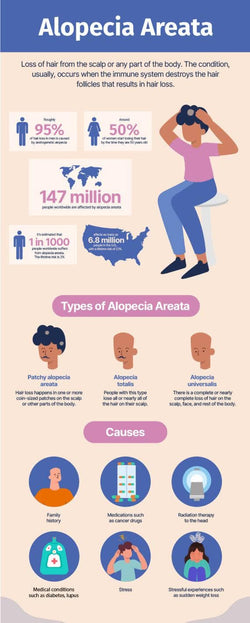 Health-Infographics Infographics Beige and Nude Alopecia Areata Health Infographic Template powerpoint-template keynote-template google-slides-template infographic-template